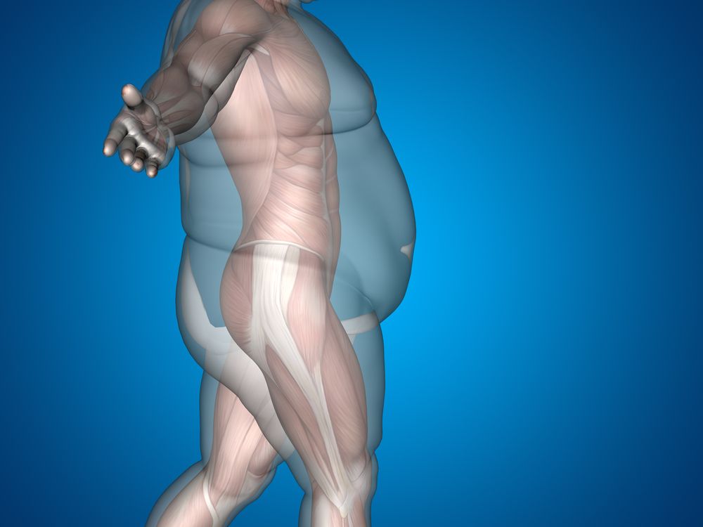 OBESITY-INDUCED ARTHRITIS IS NOT ALL THAT IT SEEMS