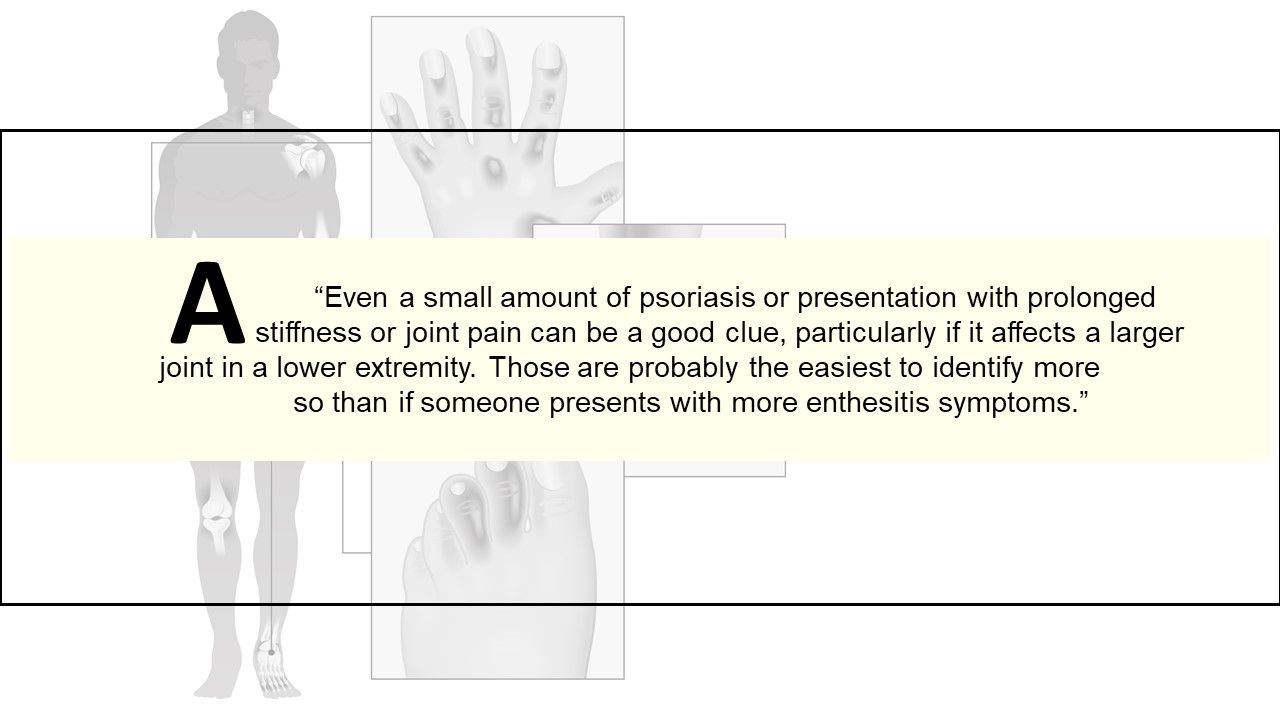 Nurse Practitioner Q&A: Psoriatic Arthritis 101