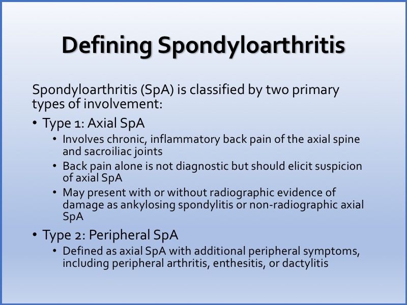 Spondyloarthritis Redefined New Diagnostic Classifications Rheumatology Network