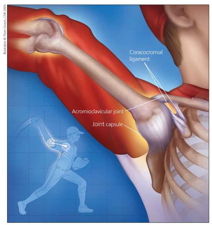 Risk Assessment And Prevention Of Arm Injuries In Baseball Players Risk Assessment And Prevention Of Arm Injuries In Baseball Players