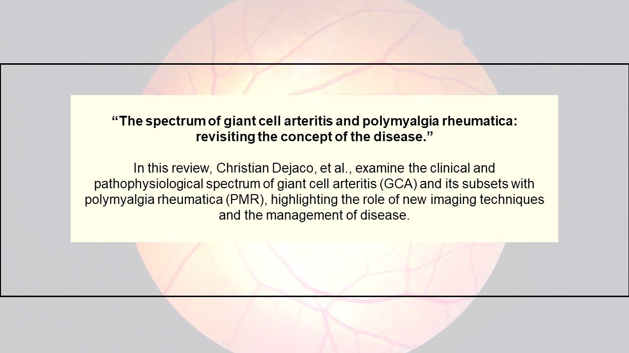 10 Most Cited Studies from the Journal Rheumatology Begins with Lupus