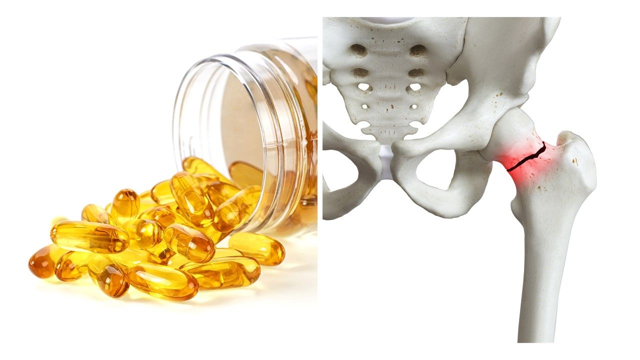 Fast Facts on Vitamin D, Calcium and Fracture