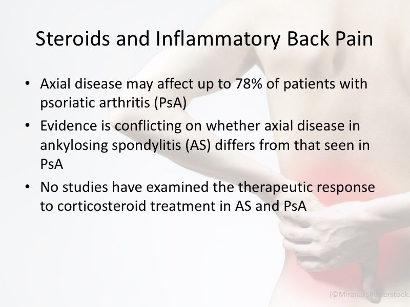 Axial Psoriatic Arthritis and Corticosteroids