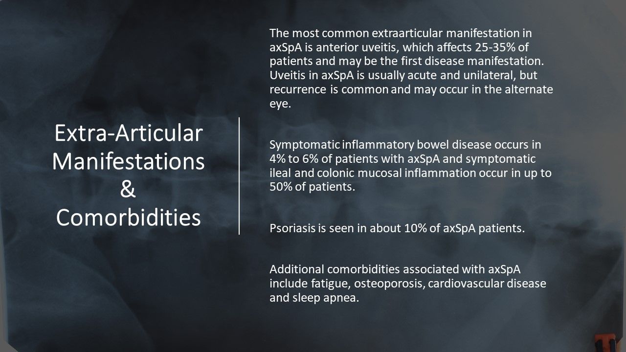 Recognizing Axial Spondyloarthritis in Primary Care 