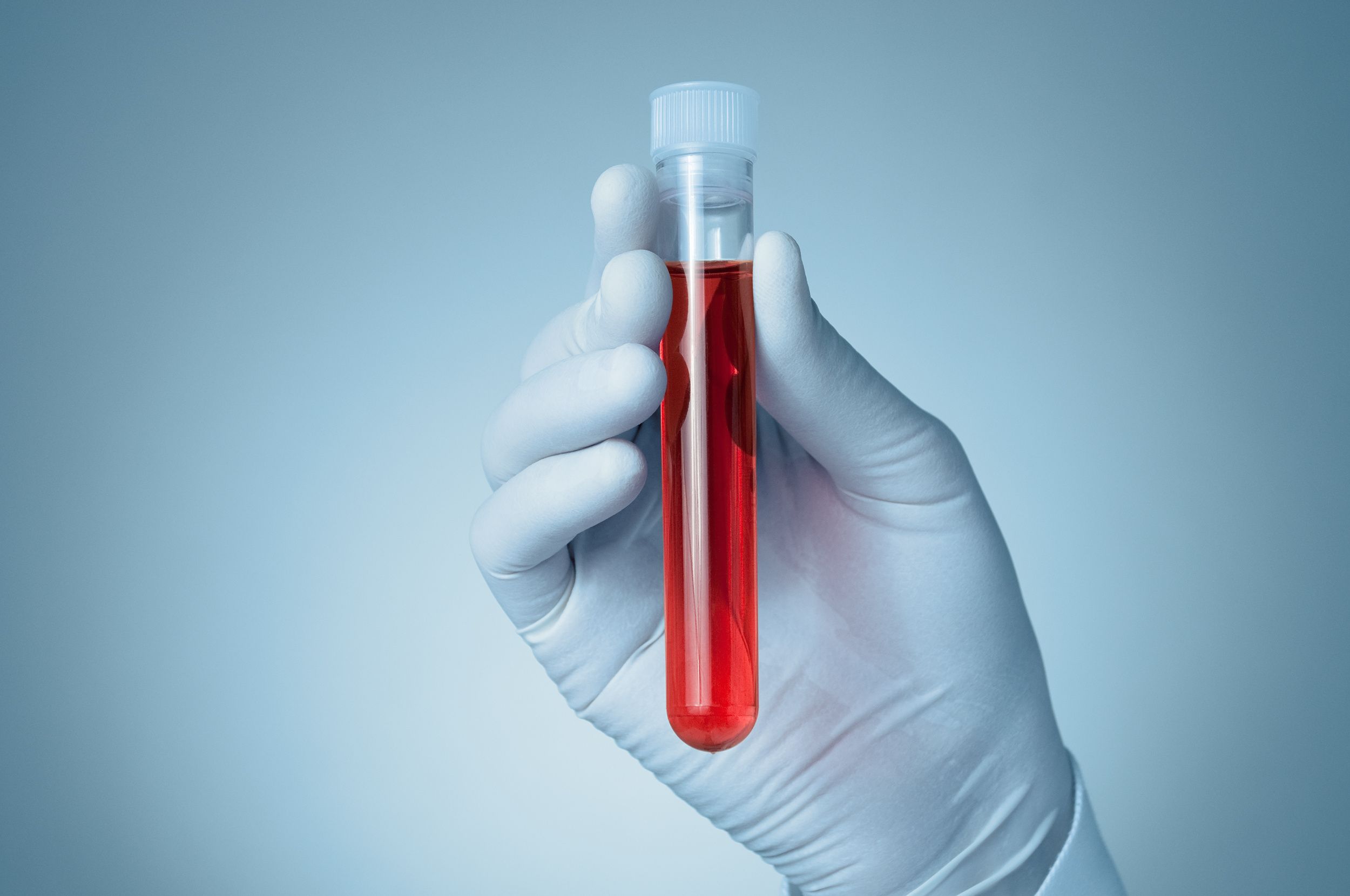 Hand with blood sample | Image Credit: © Csaba Deli - stock.adobe.com.