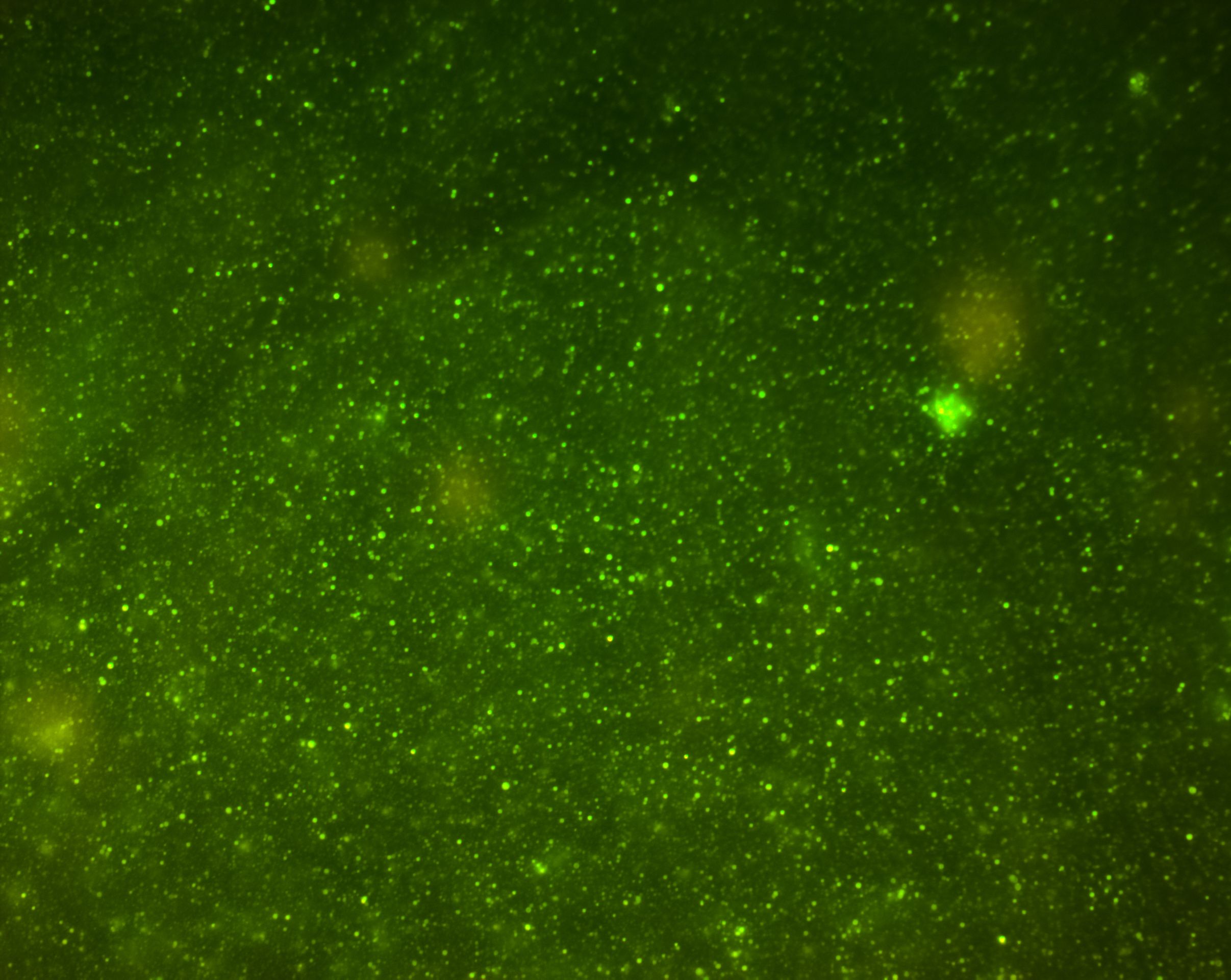 Micrography, microphotography of vesicles, particles or green fluorescent cells for scientific research, taken under a high-tech microscope. Fluorescence of curcumin and other fluorophores of interest | Image Credit: © DavidBautista - stock.adobe.com