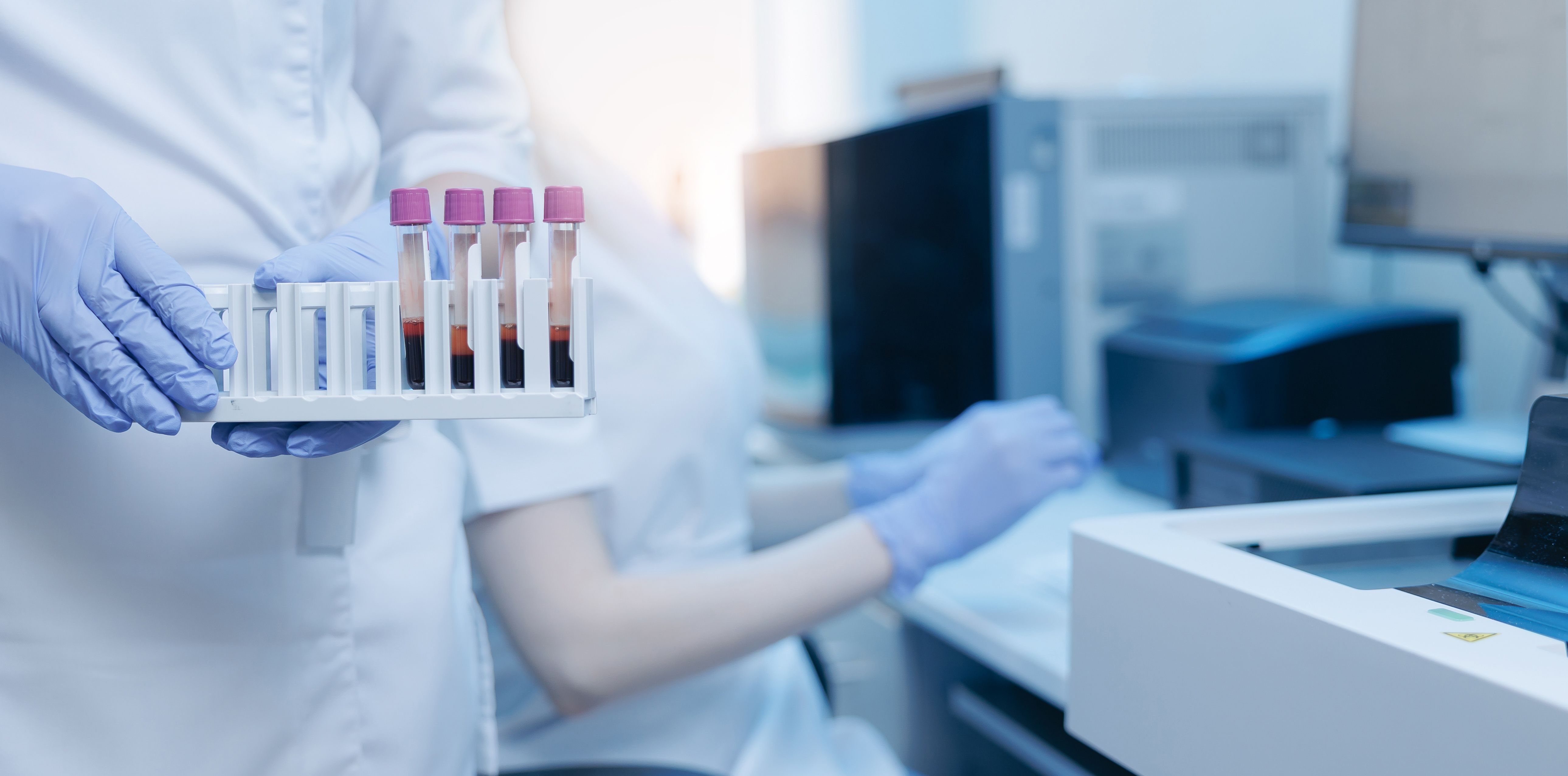 Laboratory technician holding blood sample tubes for clinical testing and diagnostic analysis with analyzer equipment in medical laboratory workstation | Image Credit: © Parilov - stock.adobe.com