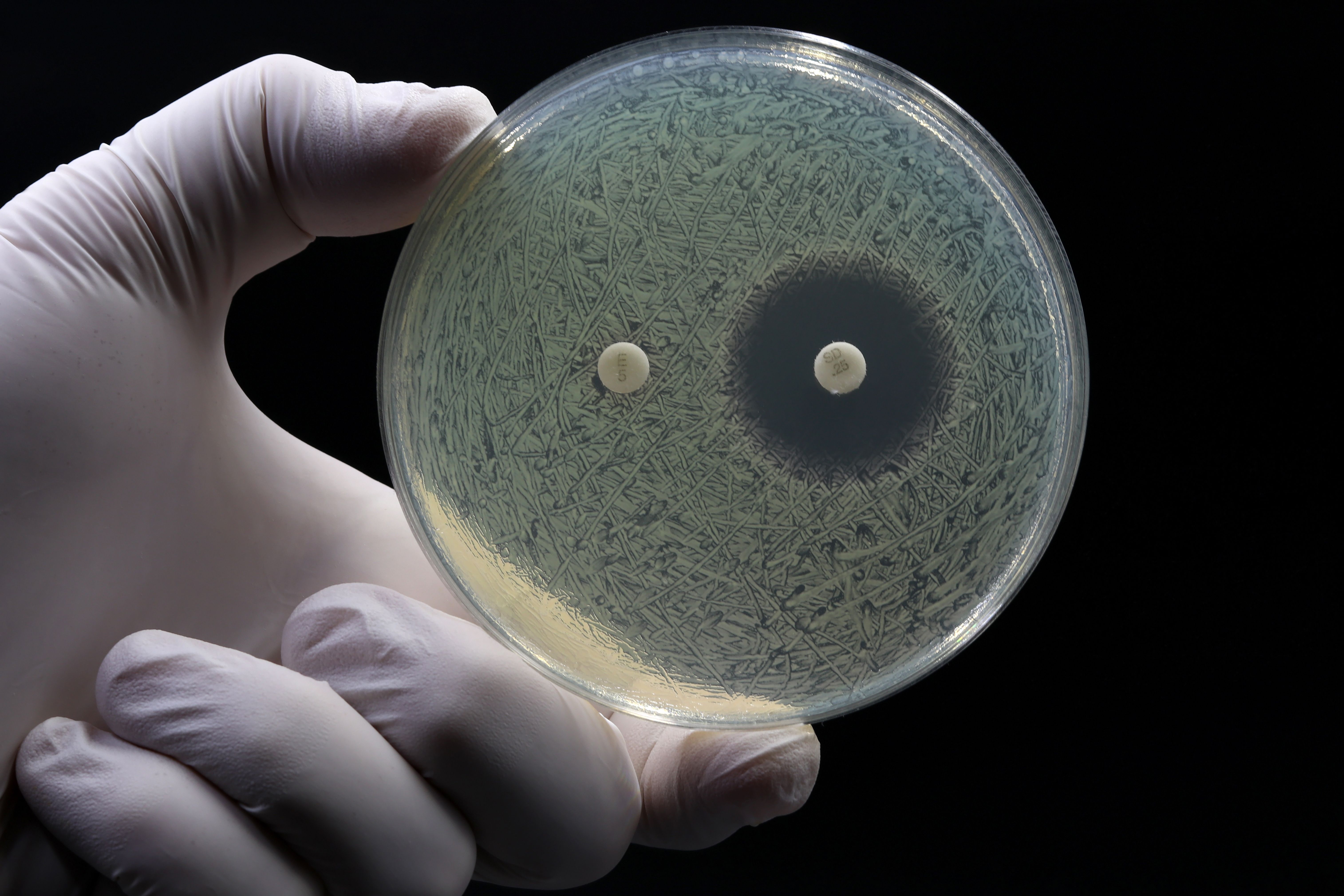 A doctor's or researcher's hand holding a Petri dish with a culture of bacteria on which an antibiotic disc test is performed. Antimicrobial resistance concept. | Image Credit: © TopMicrobialStock - stock.adobe.com