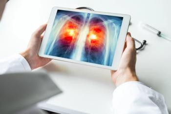 Doctor watching a xray of lung cancer on digital tablet. Radiology concept | Image Credit: © steph photographies - stock.adobe.com