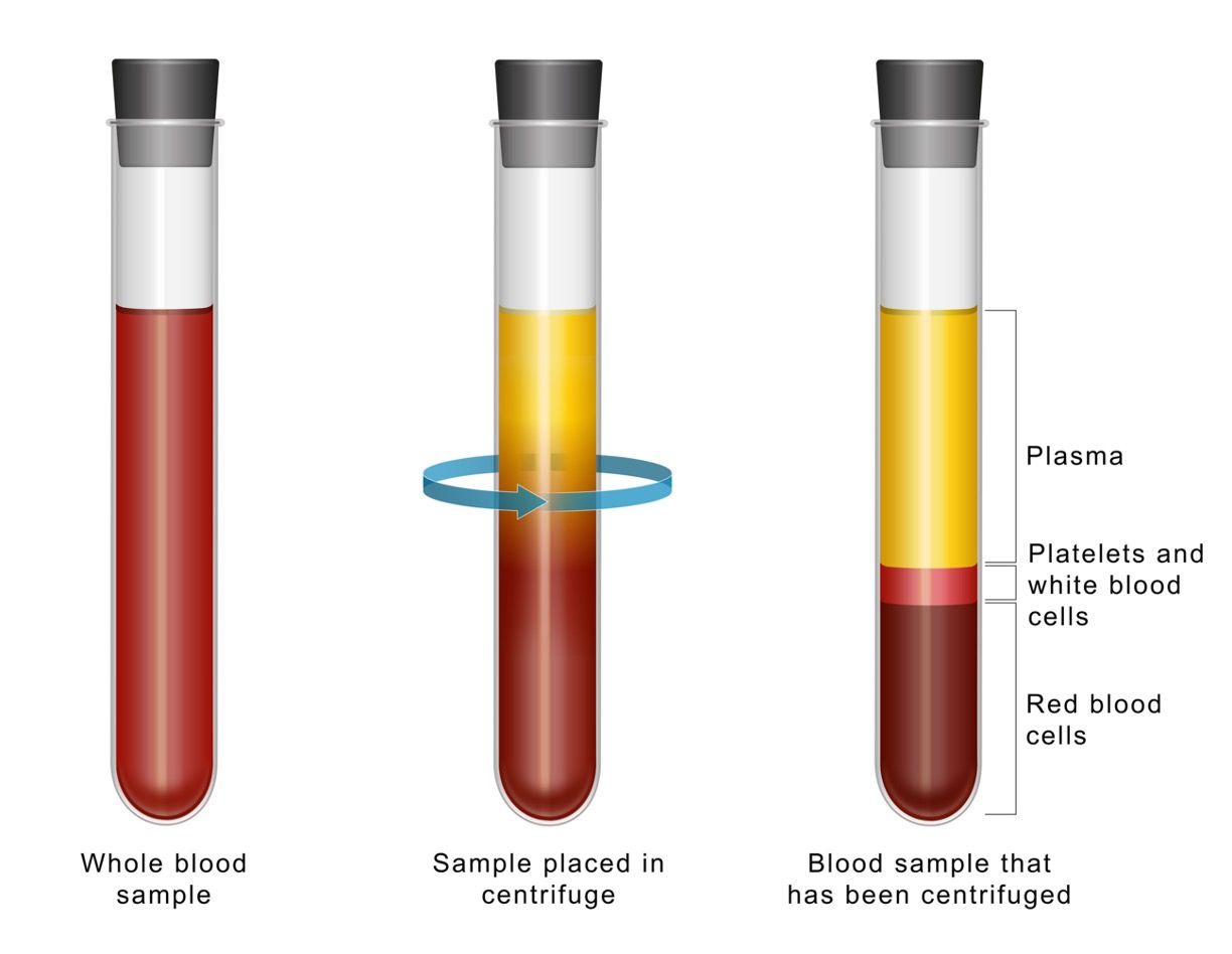 NIR aquaphotomics blood test uses light with water patterns © By Aldona -chronicles-stock.adobe.com  