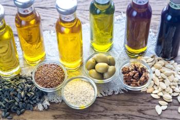 Different types of vegetable oils © alex9500-chronicles-stock.adobe.com 