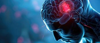 A 3D representation of a brain tumor © 220 AI Studio - stock.adobe.com