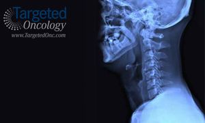 Oncolytic Vaccines With Chemotherapy Show Survival Benefit in Head and Neck Cancer