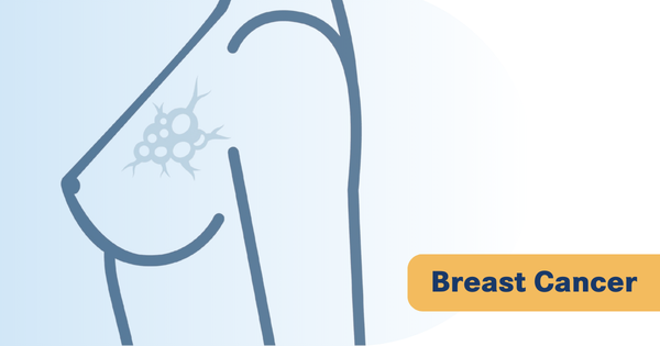 GLSI-100 Vaccine Shows <1% Annual Recurrence Rate in Phase 3 Breast Cancer Trial