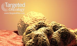 Brain Metastases in NSCLC Increasing and Require Personalized Treatment