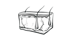 EP. 7 Tumor Infiltrating Lymphocyte Data Signal Promise for New Options to Treat Advanced Melanoma