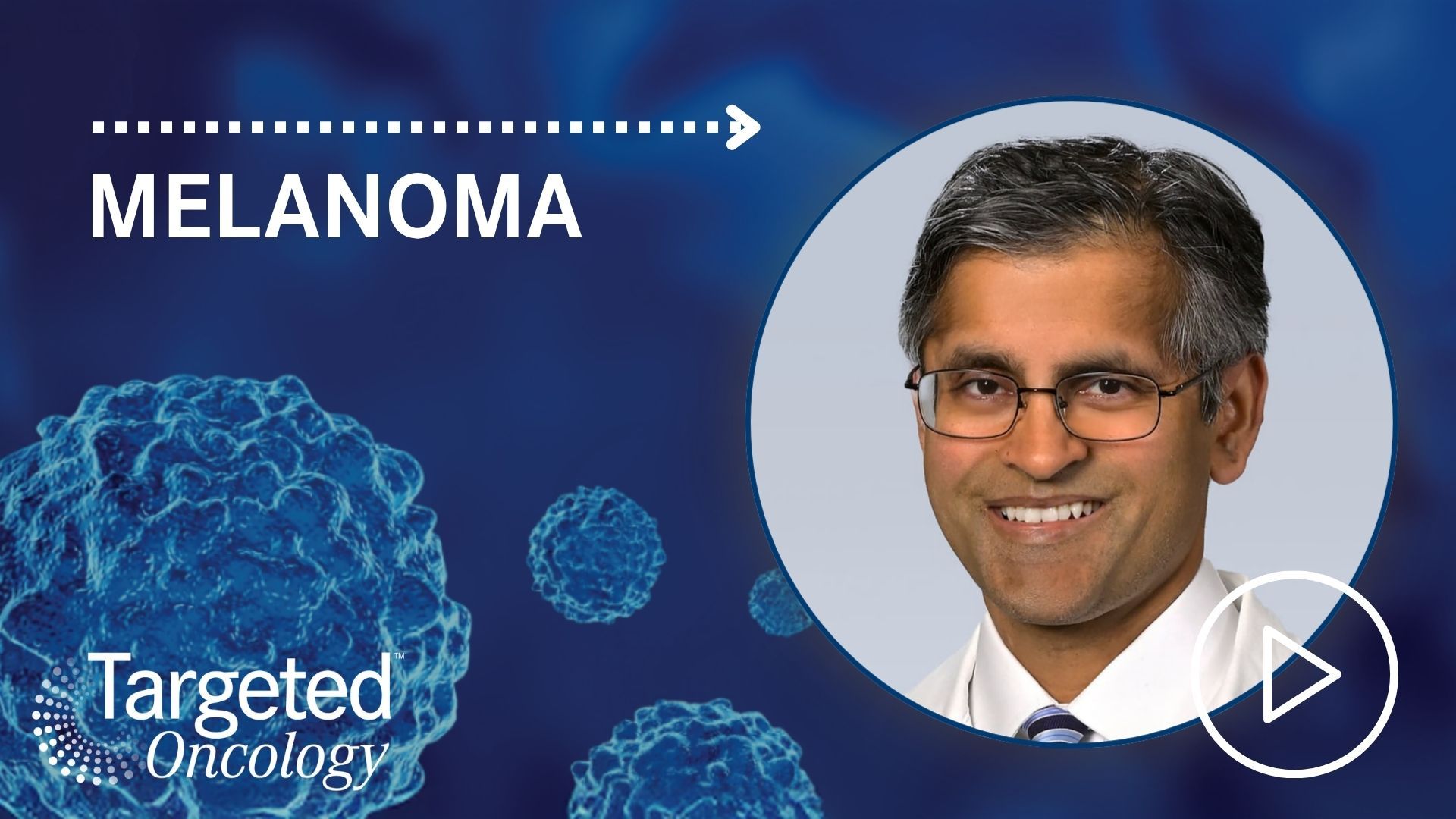 Streamlining the TIL Therapy Pipeline for Melanoma