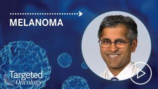 Streamlining the TIL Therapy Pipeline for Melanoma