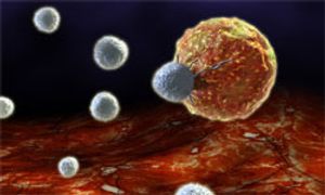 Novel Immunotherapeutic Shows Efficacy in Phase I Melanoma Trial