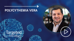 Rusfertide Poised to Ease Phlebotomy Burden in PV Care