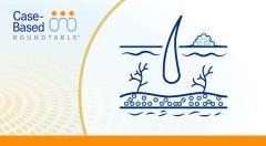 EP. 11 Experience Shapes Use of Dual Immunotherapy in Advanced Melanoma