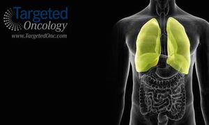Current Systemic Management of Pleural Malignant Mesothelioma