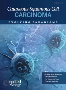 Cutaneous Squamous Cell Carcinoma