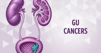 UGN-101 Shows Durable Responses in Urothelial Cancer in 5-Year Follow-Up