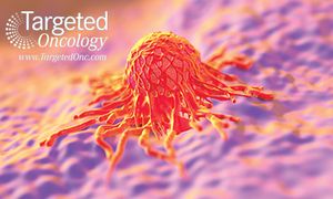 Metastatic Hormone-Sensitive Prostate Cancer Should Include Docetaxel Alongside ADT