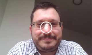 Further Research Required to Find Biomarkers for Urothelial Cancer