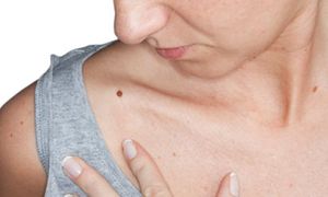 New Device Treats Nonmelanoma Skin Cancer Noninvasively