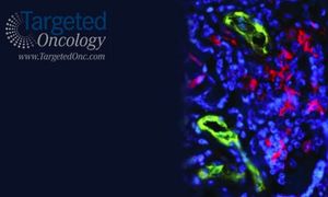 Epigenetic-Active Agents May Improve Sensitivity to Temozolomide in Melanoma