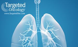 Reinvestigation of FGFR Inhibitors in Lung Cancer Under Way