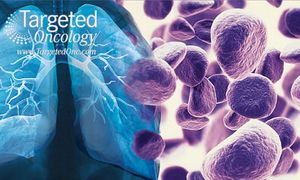 Anamorelin Shows Increased Survival in Non-Small Cell Lung Cancer