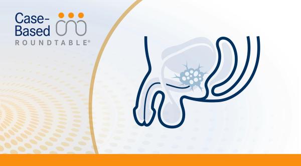 Considering the Evolution of ARPI Combination Therapy in mHSPC 