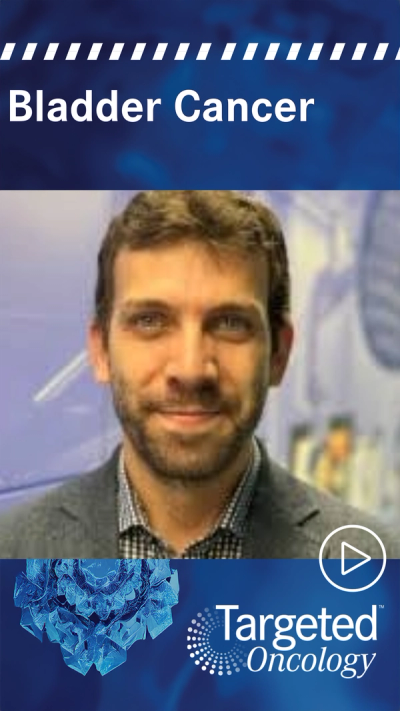 Intravesical Erdafitinib Evaluated in Phase 1 NMIBC Trial