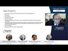 EP. 20 Case 4: A 68-Year-Old Man With Primary Myelofibrosis