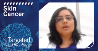 Blocking Nitrosylation Boosts MEK Inhibitors in Aggressive Melanoma