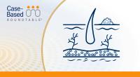 When Consensus Outpaces Capacity in Second-Line Melanoma