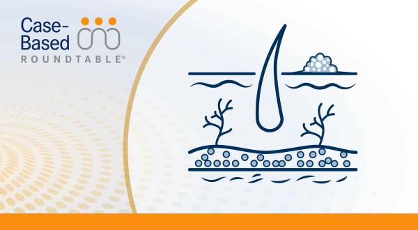 Considering Lifileucel Use in Patients With Brain-Metastatic Melanoma