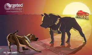 Ovarian Cancer Immune Response May Be Restored by Fighting XBP1 