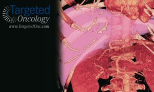 Transplant Versus Resection for Hepatocellular Carcinoma