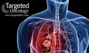 Novel NSCLC Vaccine Successfully Reaches a Phase III Trial