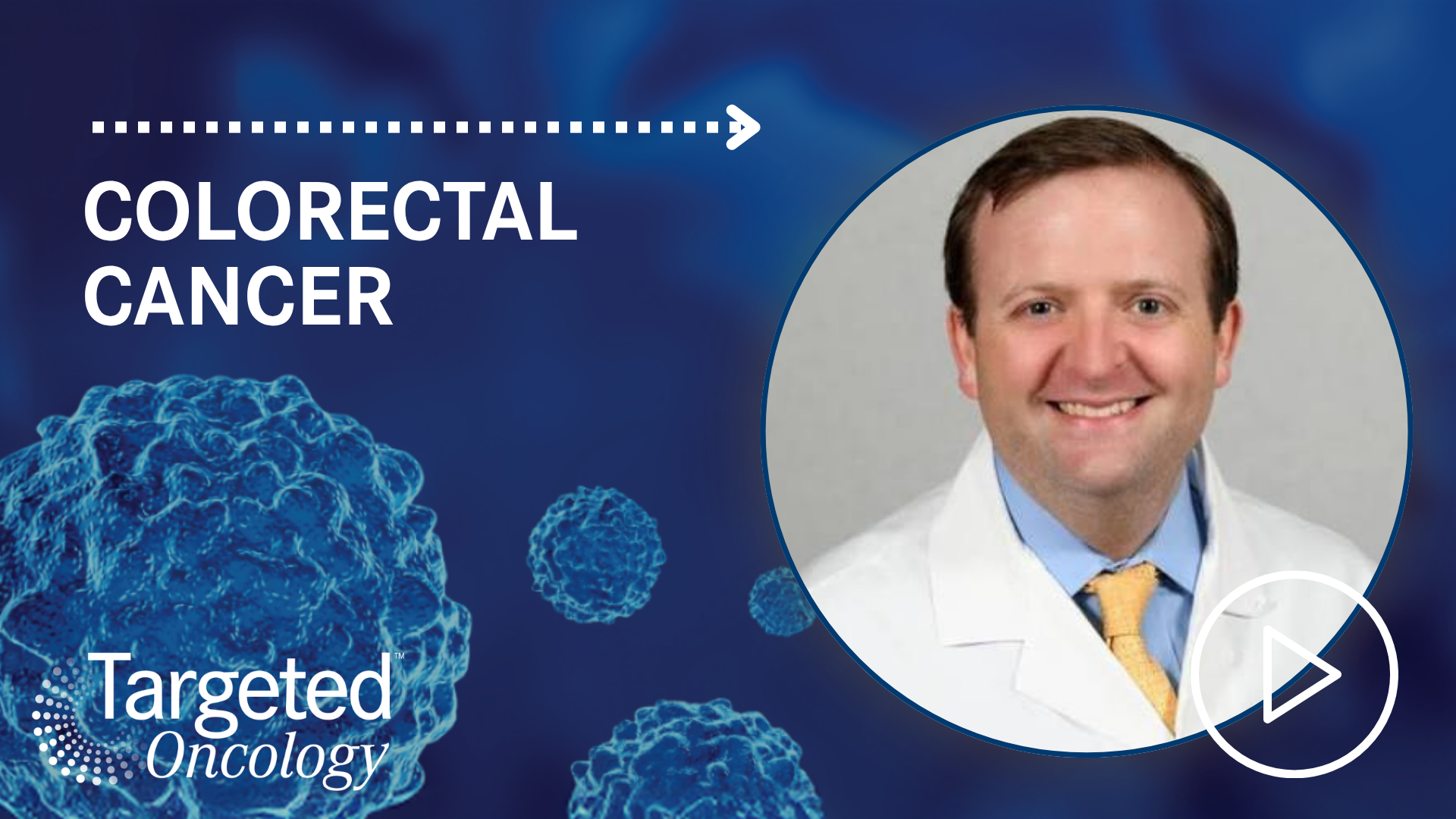 Dostarlimab Receives FDA Approval for MSI-H/dMMR Locally Advanced Rectal Cancer