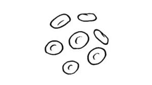 Addressing MDS Treatment Gap Post Hypomethylating Failure