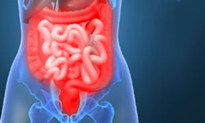 Potential Predictive and Prognostic Biomarkers for Ziv-Aflibercept Treatment Identified