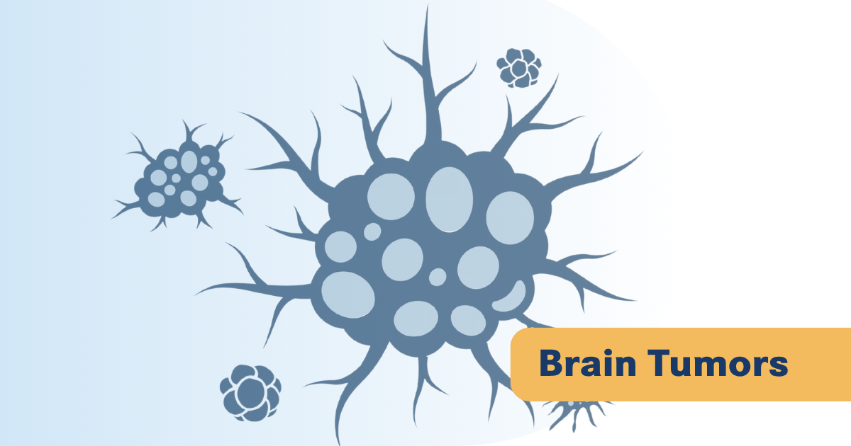 NCCN Now Backs CSF Genomic Testing in Gliomas When Biopsy Isn't ...