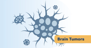 Reanalysis of Glioblastoma Vaccine Trial Suggests Larger Survival Benefit