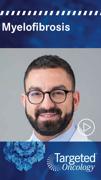 PIM Inhibitor Shows Promise in High-Risk Myelofibrosis