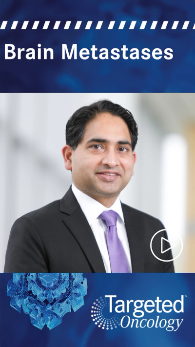 From 6 Months to 5 Years: The New Era of Brain Metastasis Survival